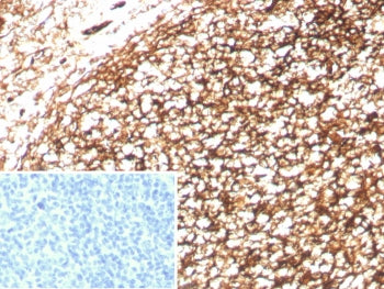 IHC staining of FFPE human tonsil tissue with Complement receptor 1 antibody (clone CD35/8833R). Ins