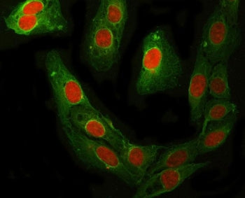 RFC4 Antibody / RCF37 / Replication factor C subunit 4