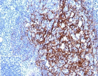 IHC staining of FFPE human tonsil tissue with CD23 antibody (clone FCER2/4918) at 2ug/ml in PBS for 30min RT. Negative control inset: PBS used instead of primary antibody to control for secondary Ab binding. HIER: boil tissue sections in pH 9 10mM Tris with 1mM EDTA for 20 min and allow to cool before testing.