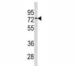 Western blot analysis of CEA antibody and 293 lysate. Expected molecular weight: 80~200 kDa dependin