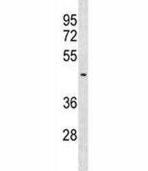 SUV39H2 Antibody