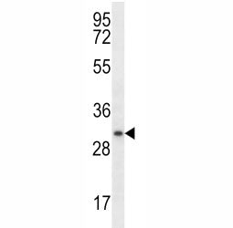 Myogenin antibody western blot analysis in ZR-75-1 lysate. Predicted molecular weight ~25 kDa, routi