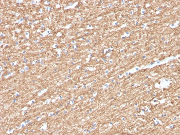 IHC staining of FFPE human brain with Myelin Basic Protein antibody (clone MBP/4276). HIER: boil tis