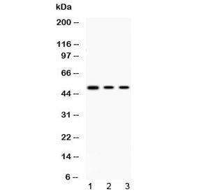PRKAR1A Antibody