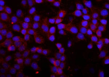 Immunofluorescent staining of FFPE human A431 cells with MMP16 antibody (red) and DAPI nuclear stain