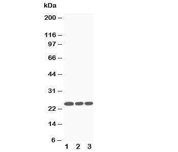 SOCS3 Antibody