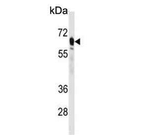 Western blot testing of human HepG2 cell lysate with PEPCK2 antibody. Predicted molecular weight ~71