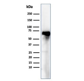 Albumin Antibody / ALB
