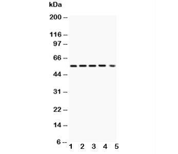 Western blot testing of Akt1 antibody and Lane 1: rat ovary; 2: (r) PC-12; 3: human A549; 4: (h) MCF