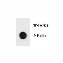 Dot blot analysis of phospho-TSC1 antibody. 50ng of phos-peptide or nonphos-peptide per dot were spo