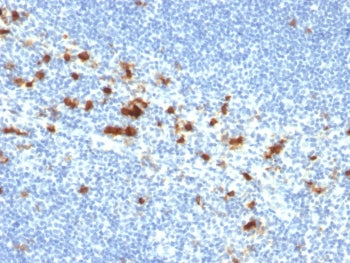 IHC testing of FFPE human tonsil with CD103 antibody (clone ITGAE/2474). HIER: boil tissue sections 