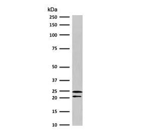 Western blot testing of human Jurkat cells with CD3e antibody (clone CDLA3e-1). Expected molecular w