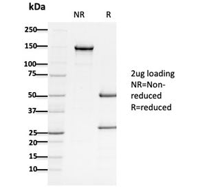 APC Antibody / Adenomatous polyposis coli