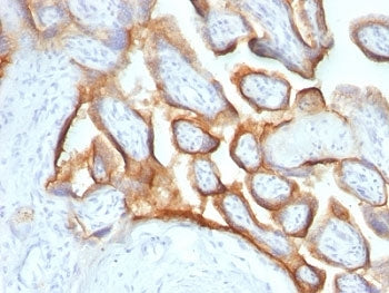 hCG alpha Antibody / Luteinizing Hormone alpha