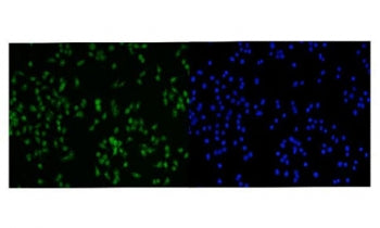 Immunofluorescent staining of FFPE human Caco-2 cells with PRMT3 antibody (green) and DAPI nuclear s