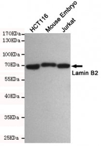 Western blot testing of 1) human HCT116, 2) mouse embryo and 3) human Jurkat cell lysates using Lami