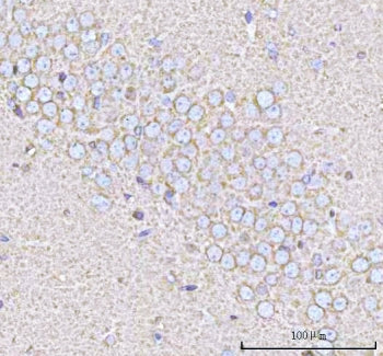 IHC staining of FFPE rat brain tissue with Calcineurin B antibody. HIER: boil tissue sections in pH8