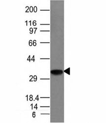 CD74 / CLIP Antibody