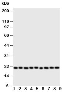 Western blot testing of Cytoglobin antibody and Lane 1: rat brain; 2: (r) small intestine; 3: (r) li