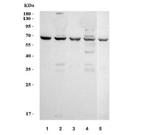 TNF Receptor II Antibody / TNFR2