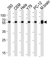 Western blot analysis of lysate from 293, CEM, HeLa, Y79, rat PC-12 cell line, mouse brain tissue ly