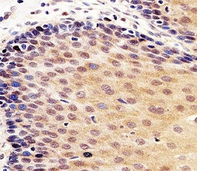 p53 Antibody