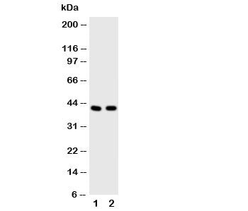 Western blot testing of HDAC8 antibody and Lane 1: rat heart; 2: human A549 cell lysate