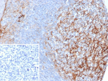 IHC staining of FFPE human tonsil tissue with ICAM-1 antibody (clone ICAM1/6606). Inset: PBS used in