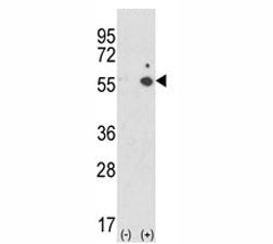 ICAM-1 Antibody