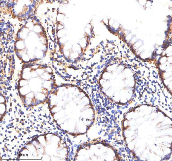 Immunohistochemical staining of MATK using anti-MATK antibody. MATK was detected in a paraffin-embed