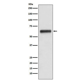 Western blot testing of human plasma lysate with Human IgG3 antibody. Predicted molecular weight ~50