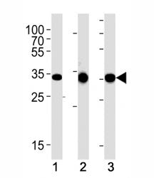 Cyclin D1 Antibody (CCND1)