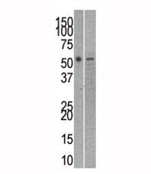 Reptin antibody used in western blot to detect RUVBL2 in mouse kidney (left) and human SK-BR-3 (righ