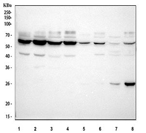 Western blot testing of human recombinant protein with TIM1 antibody. Predicted molecular weight~39 