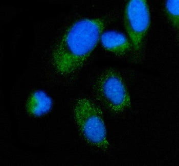 Immunofluorescent staining of FFPE human PC-3 cells with ALAS2 antibody (green) and DAPI nuclear sta
