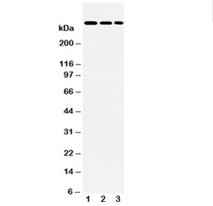 LAMA2 Antibody Laminin 2 alpha