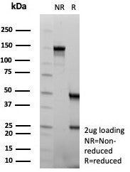 SDS-PAGE analysis of purified, BSA-free ENO2 antibody (clone rENO/8684) as confirmation of integrity