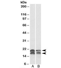 Western blot testing of A549 [A] and HeLa [B] lysates with NME1 antibody at 0.01ug/ml. Predicted mol