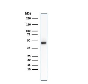 Western blot testing of human HCT-116 cell lysate with recombinant Cytokeratin 8 antibody (clone KRT
