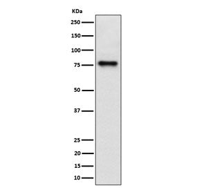Western blot testing of human HepG2 cell lysate with TRIP10 antibody. Expected molecular weight: 40-