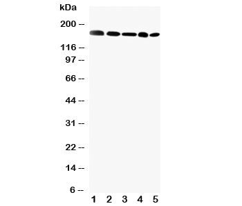 Western blot testing of GLI2 antibody and Lane 1: MCF-7; 2: HeLa; 3: SKOV; 4: HT1080; 5: A549 cell l