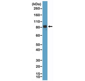 Western blot testing of human brain tissue with recombinant Chromogranin A antibody at 1:1000. Predicted molecular weight ~51 kDa but may be observed at higher molecular weights due to glycosylation.