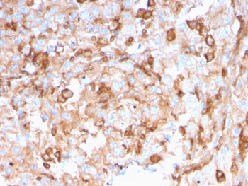 IHC testing of FFPE human kidney with SERBP1 antibody (clone SERBP1/3496). Required HIER: boil tissu