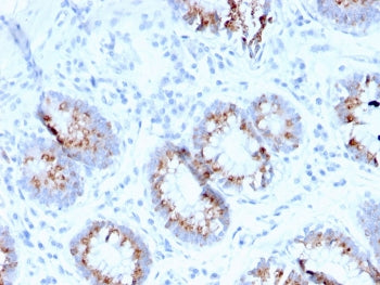 IHC staining of FFPE human colon with MerTK antibody (clone MERTK/3015). HIER: boil tissue sections 