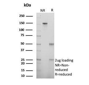 SDS-PAGE analysis of purified, BSA-free S100 Calcium Binding Protein A2 antibody (clone rS100A2/6482