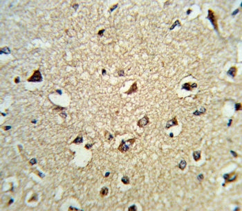 IHC testing of FFPE human brain tissue with ARHGDIA antibody. HIER: steam section in pH6 citrate buf