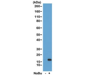 Western blot of acid extracts from HeLa cells untreated (-) or treated (+) with sodium butyrate usin