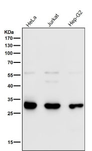 Western blot testing of human samples using the VAPA antibody at 1:1000 dilution for 1 hour at room 