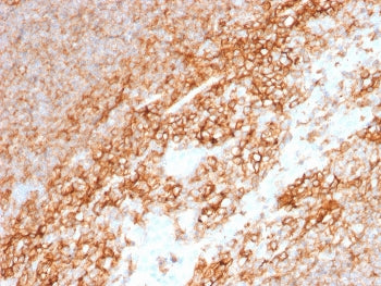 CD44 Antibody / HCAM
