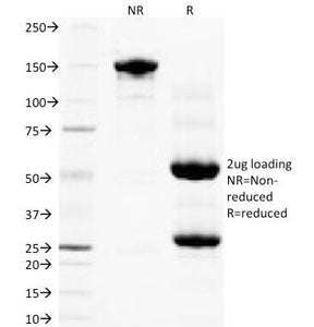 PLGF Antibody / PGF / Placenta Growth Factor